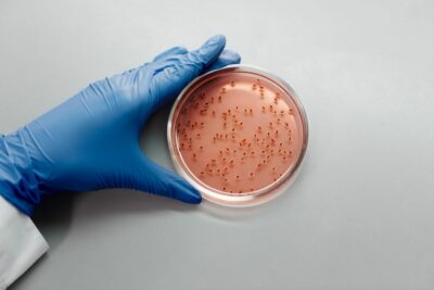 Désinfectants et antibiotiques : l’Anses met en évidence des mécanismes de résistance communs